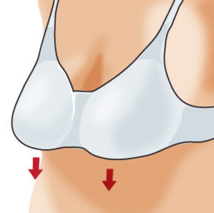bra band fit front comes down